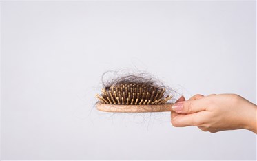 ما هي التحاليل الطبية التي تكشف لكم سبب تساقط الشعر بكثافة؟ 
